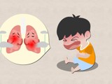 频上热搜！家长最关心的“支原体肺炎”究竟是个啥？